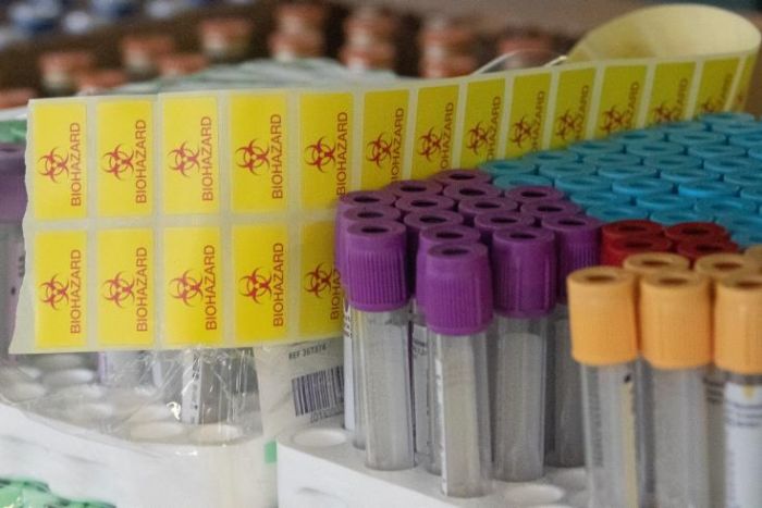 &Theta;&epsilon;&tau;&iota;&kappa;ό &kappa;&rho;&omicron;ύ&sigma;&mu;&alpha; COVID-19 &sigma;&tau;&eta;&nu; &upsilon;&pi;&epsilon;&rho;&alpha;&gamma;&omicron;&rho;ά &Sigma;&kappa;&lambda;&alpha;&beta;&epsilon;&nu;ί&tau;&eta;&sigmaf; &sigma;&tau;&eta;&nu; Έ&gamma;&kappa;&omega;&mu;&eta;