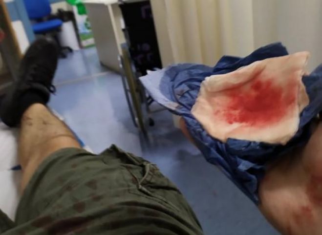 &Eta; &Epsilon;&lambda;&lambda;ά&delta;&alpha; &sigma;&tau;&eta;&nu; &ldquo;&alpha;&sigma;&tau;&upsilon;&nu;&omicron;&mu;&omicron;&kappa;&rho;&alpha;&tau;ί&alpha;&rdquo; &tau;&eta;&sigmaf;... &Nu;.&Delta;.:  &Mu;&alpha;&rho;&tau;&upsilon;&rho;ί&alpha; - &sigma;&omicron;&kappa; &gamma;&iota;&alpha; &tau;&eta;&nu; &epsilon;&pi;&iota;&delta;&rho;&omicron;&mu;ή &tau;&eta;&sigmaf; &Alpha;&sigma;&tau;&upsilon;&nu;&omicron;&mu;ί&alpha;&sigmaf; &sigma;&tau;&alpha; &Epsilon;&xi;ά&rho;&chi;&epsilon;&iota;&alpha;