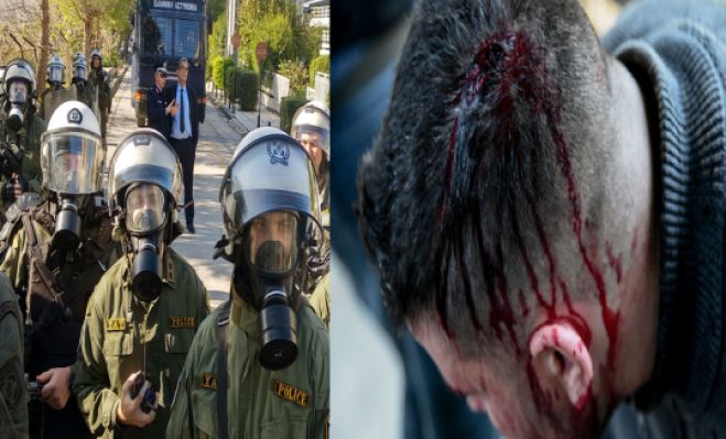 &Epsilon;&lambda;&lambda;ά&delta;&alpha;: &Tau;&rho;&alpha;&upsilon;&mu;&alpha;&tau;&iota;&sigma;&mu;ό&sigmaf; 4 &phi;&omicron;&iota;&tau;&eta;&tau;ώ&nu;-&mu;&epsilon;&lambda;ώ&nu; &tau;&eta;&sigmaf; &Kappa;&Nu;&Epsilon; &alpha;&pi;ό &epsilon;&pi;ί&theta;&epsilon;&sigma;&eta; &tau;&omega;&nu; &Mu;&Alpha;&Tau;