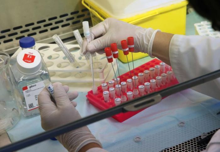 &Kappa;ύ&pi;&rho;&omicron;&sigmaf;: Ά&nu;&delta;&rho;&alpha;&sigmaf; 78 &epsilon;&tau;ώ&nu; &tau;&omicron; &nu;έ&omicron; &theta;ύ&mu;&alpha; &tau;&omicron;&upsilon; &kappa;&omicron;&rho;&omega;&nu;&omicron;ϊ&omicron;ύ