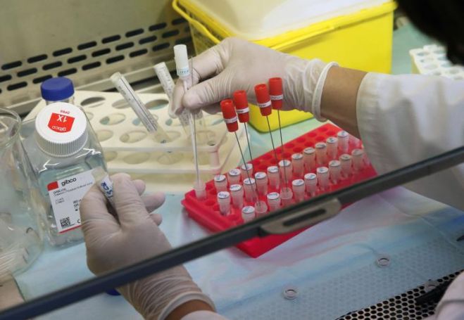 &Kappa;ύ&pi;&rho;&omicron;&sigmaf;: Ά&nu;&delta;&rho;&alpha;&sigmaf; 78 &epsilon;&tau;ώ&nu; &tau;&omicron; &nu;έ&omicron; &theta;ύ&mu;&alpha; &tau;&omicron;&upsilon; &kappa;&omicron;&rho;&omega;&nu;&omicron;ϊ&omicron;ύ